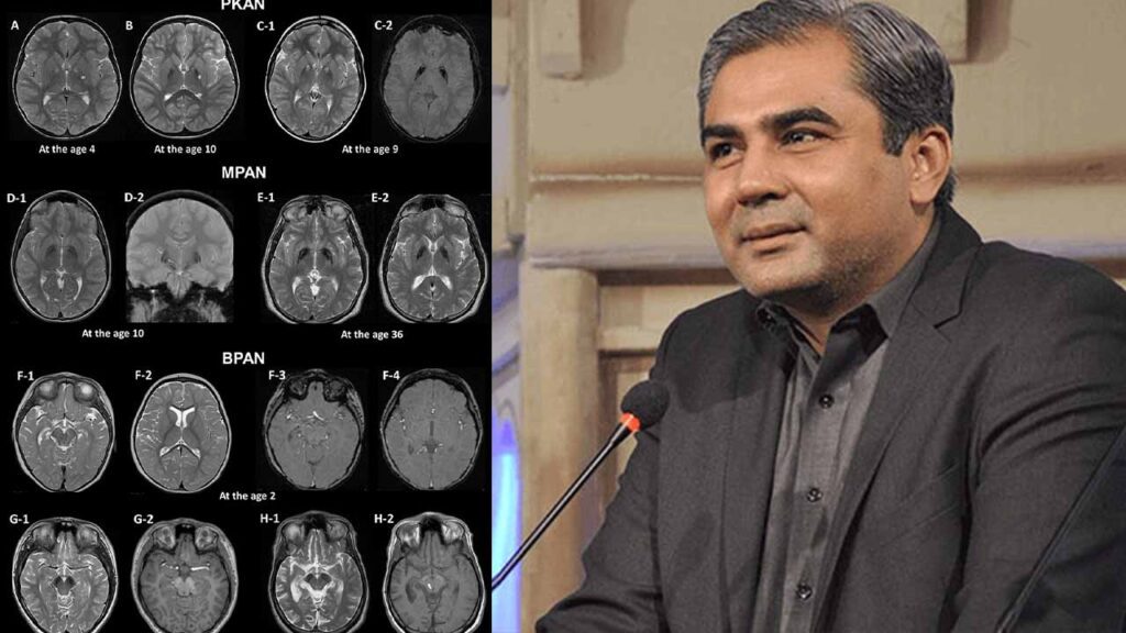CM Naqvi MRI CT Scan reports delay Lahore