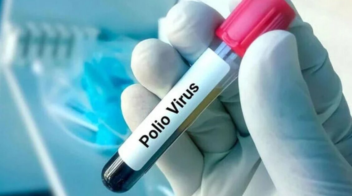 Polio