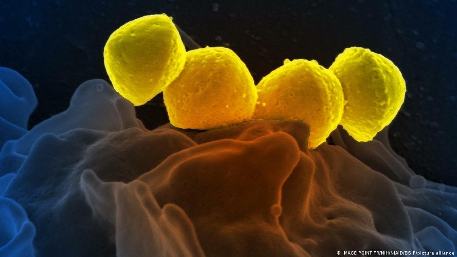 Infections from Streptococcus pyogenes bacteria are on the rise in Japan. Infections cause a deadly disease called Streptococcal toxic shock syndrome, or STSS.