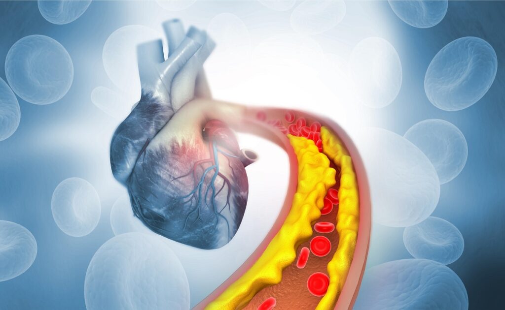 The highest dose of an experimental pill dramatically lowered an inherited form of high cholesterol in a mid-stage trial