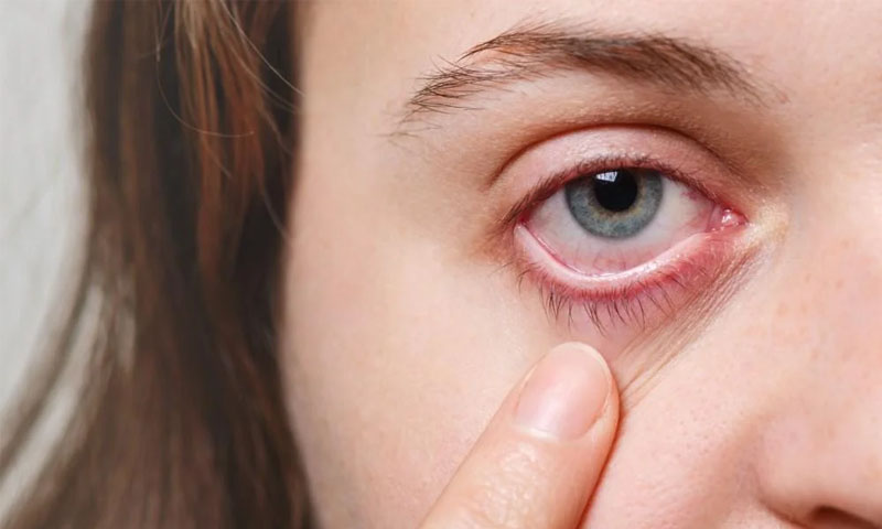 Eye infection: can pink eye cause vision loss? How to prevent it?