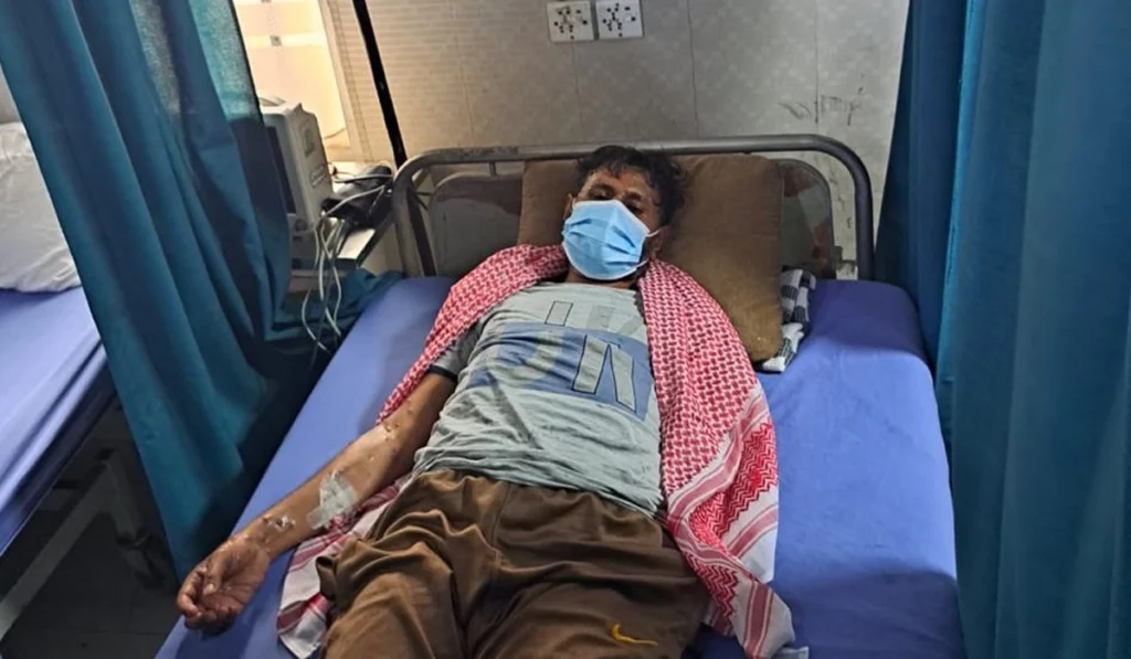 monkeypox in Lahore